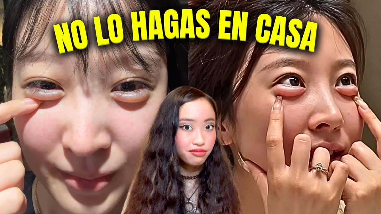 Los influencers chinos se inyectan OJERAS falsas en casa... termina en PESADILLA