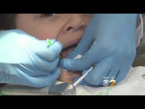 Freezing Kids' Cavities
