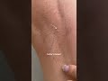 Sniff Sniff This Is Why You Re Still Stinky 🫢 Skincaretips Armpits Bodyodor Exfoliating