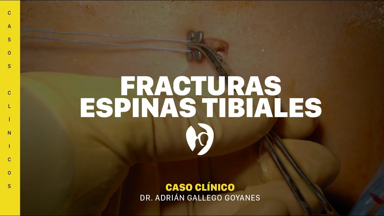 Adrián Gallego Goyanes-32