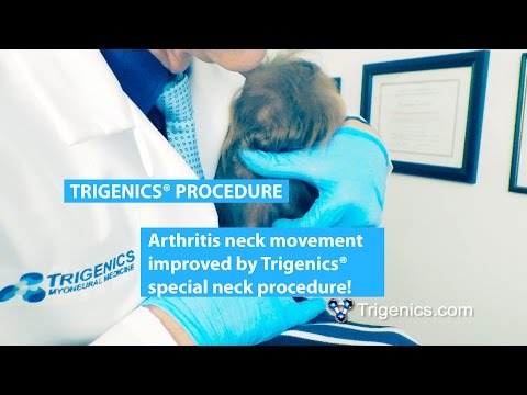 Incredible cracking neck!  How to Improve Severe Arthritis Neck Pain & Movement using Trigenics®