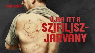 Csecsemőtől a felnőttig bárkit érinthet - miért terjed ilyen gyorsan a szifilisz?