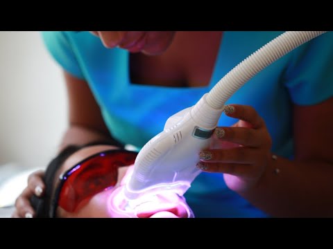 Teeth Whitening Process thumbnail