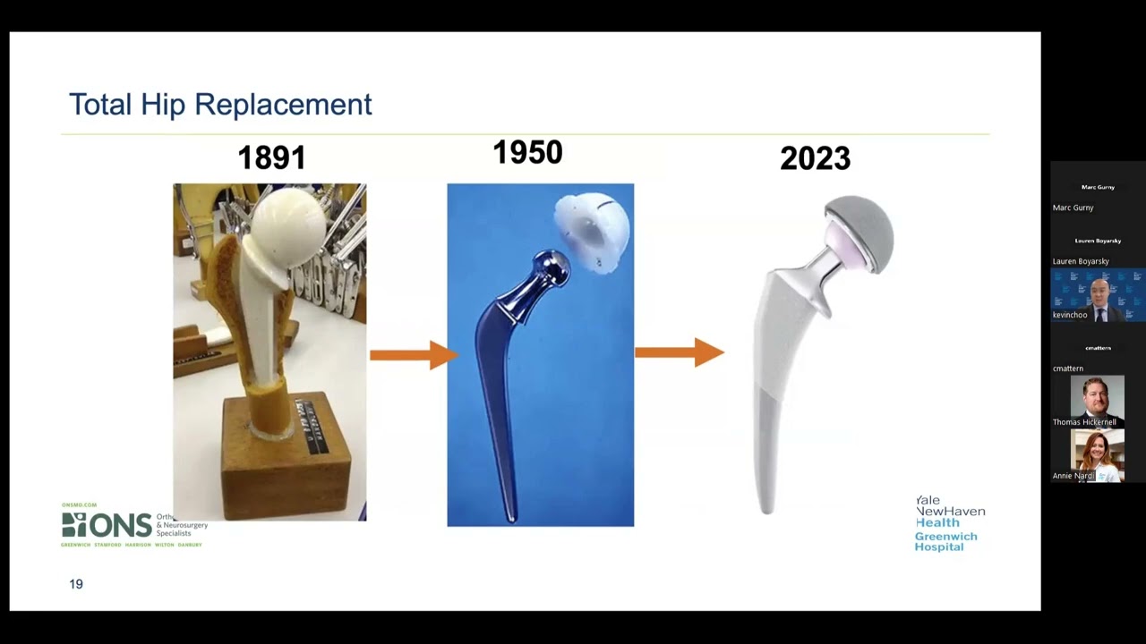 Understanding Total Joint Replacement Surgery