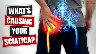 What’s Causing Your Sciatica? [Tests and Treatment At Home]