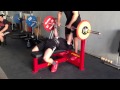 Emad breaks his arm benching Emad breaks his arm benching