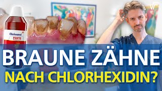 CHX / Chlorhexidin Mundspülung braune Zähne, schlechter Geschmack Das hilft!