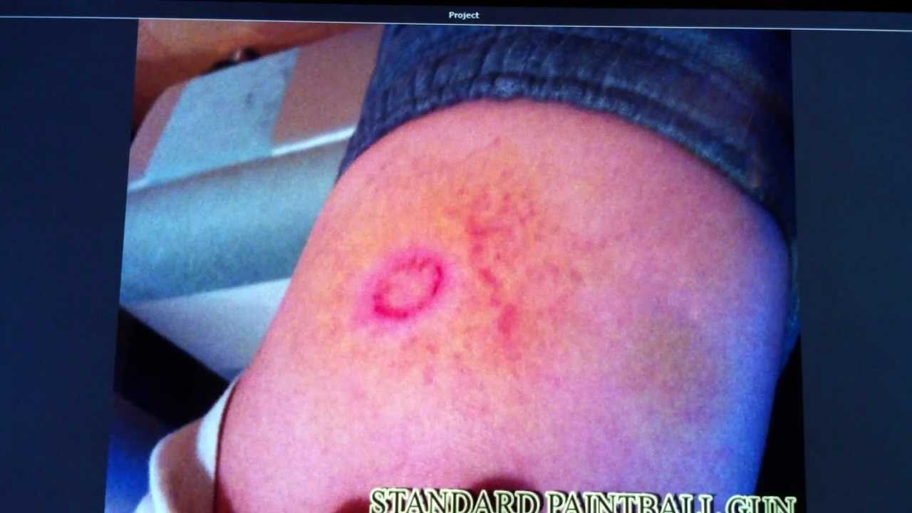 Why does my mouth feel dry and chalky? Tipseri