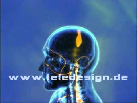 GN 009 motorische Reizleitung - SD PAL / GN 009  motor cortex - SD PAL