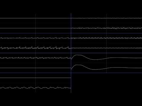 ActRaiser  - Fillmore [Oscilloscope View]