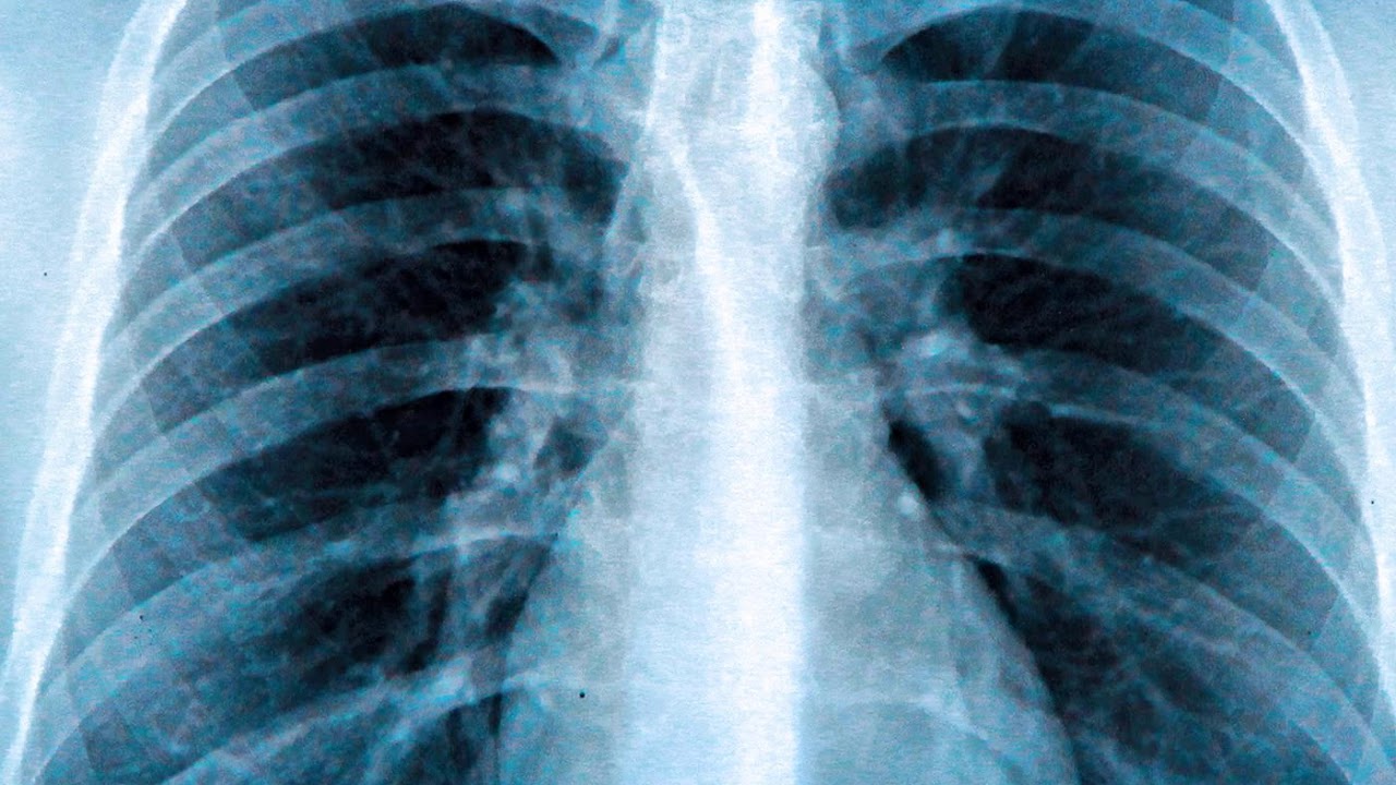 Artificial Intelligence and Medicine with Mozziyar Etemadi, MD, PhD