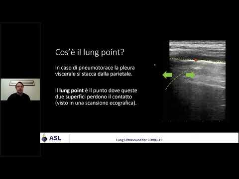 Ecografia polmonare per le USCA 6 - Pneumotorace
