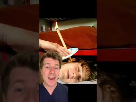Doctor explains Ear Wax (plus treatment!) #shorts #health #medical #doctor