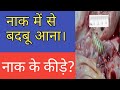 नाक में कीड़े होने का इलाज Treatment Of Nasal Worms In Hin