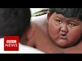 My 10 Year Old Son Weighs 188kg BBC News