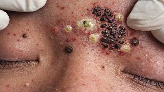 𝑺𝒐𝒐𝒕𝒉𝒊𝒏𝒈 𝑭𝒂𝒄𝒊𝒂𝒍 𝑻𝒓𝒆𝒂𝒕𝒎𝒆𝒏𝒕 𝑭𝒐𝒓 𝑺𝒕𝒓𝒆𝒔𝒔 𝑹𝒆𝒍𝒊𝒆𝒇 𝒂𝒕 𝑳𝒖𝒙𝒖𝒓𝒚 𝑺𝒑𝒂 𝑨𝒄𝒉𝒊𝒆𝒗𝒆 𝑰𝒏𝒏𝒆𝒓 𝑷𝒆𝒂𝒄𝒆 #47585