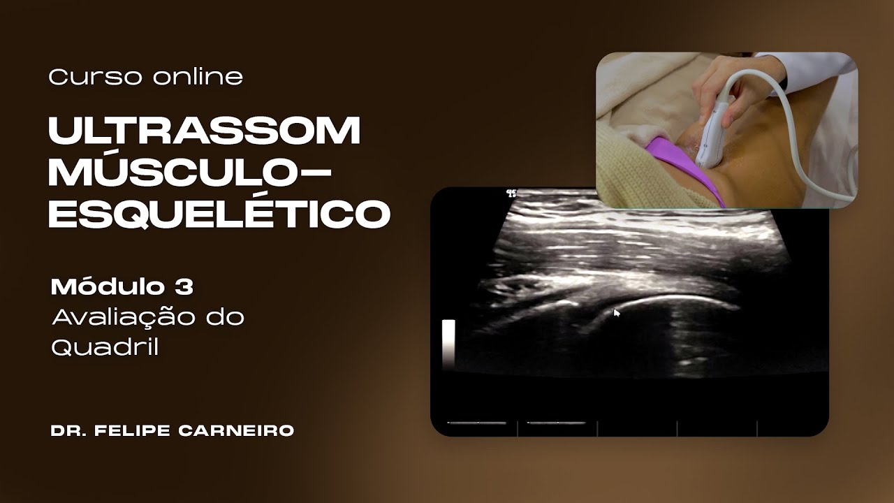 Curso USG Musculoesquelético - Módulo 3 - Avaliação do Quadril