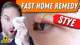 Super FAST Home Remedy For An Eyelid Stye!