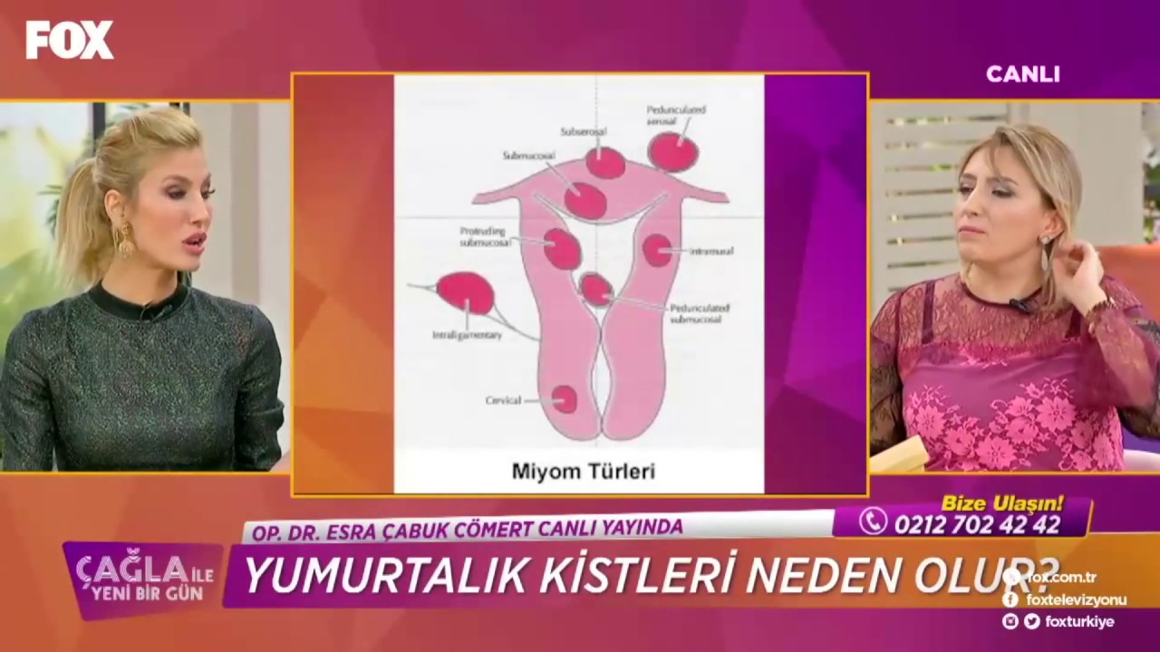 Esra Çabuk Cömert-29