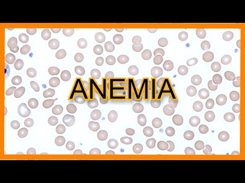 Anemia (Types, Findings, Lab Values)