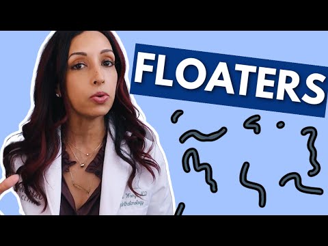 What Causes Eye Floaters? Eye Doctor Explains