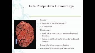 postpartum complications