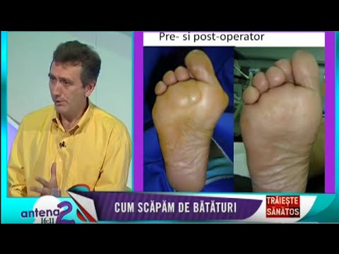 Buna crema anestezica pentru osteochondroza