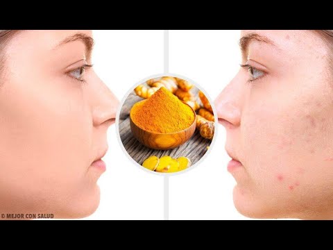 I posti di pigmentary a un occhio lo basano Decolorazione di pelle crema aspra