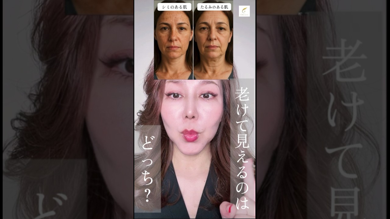 老けて見えるのはどっち？シミ肌vsたるみ肌