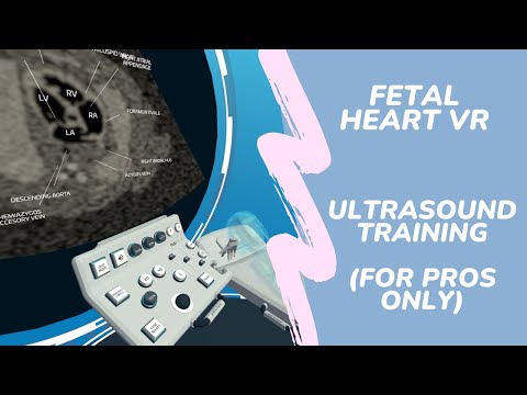 Hands-on: Quick test of Fetal Heart VR