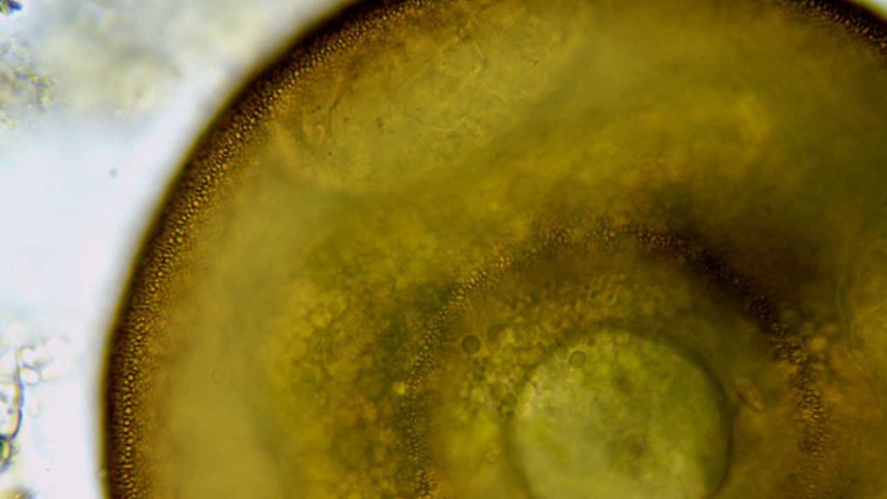 A parasitic rotifer in the shell an arcellid amoeba