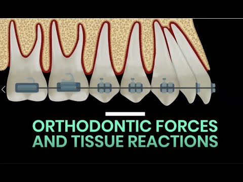 Drop #108 ORTHODONTIC FORCES AND TISSUE REACTIONS