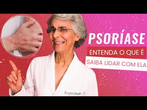 Psoríase: entenda o que é e saiba lidar com ela