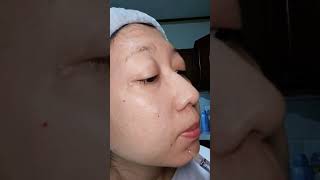 Download lagu Suntik (Injeksi) SKINBOOSTER sendiri. #skinbooster mp3 Download lagu Suntik (Injeksi) SKINBOOSTER sendiri. #skinbooster mp3