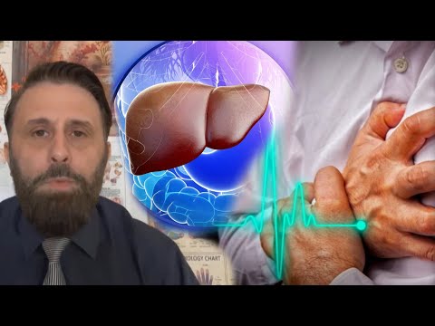 Infarkti nis në MELÇI, shenjat që rrezikojnë jetën / Kjo është analiza që mjekët nuk ja u thonë