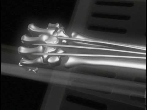 Wolverine claws x-ray