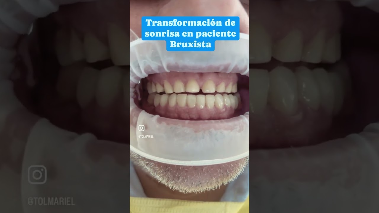 Mariel Itzayani Torres López-47