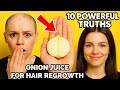 How To Apply Onion Juice For Hair Regrowth In Women Over 40