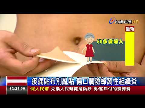 痠痛貼布別亂貼 傷口爛險蜂窩性組織炎