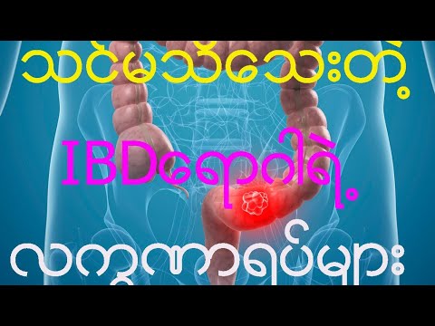 IBD သို့မဟုတ် နာတာရှည်အူမကြီးယောင်ရောဂါအ​ကြောင်း