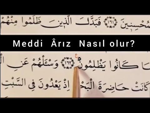 Meddi Ârız  Nasıl olur?