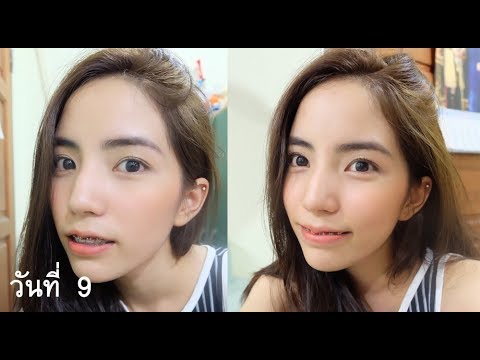 รับพรูอัตราค้อน โดยไม่ต้องสมาชิกดำเนินการ