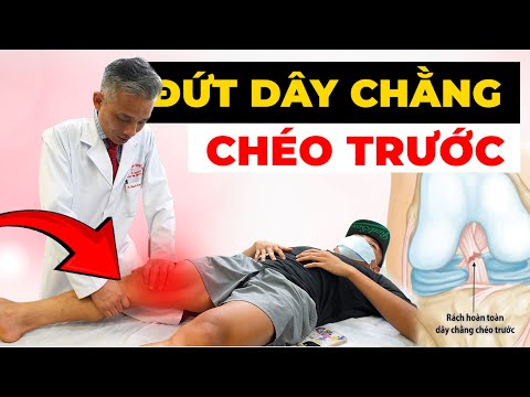 Đầu Gối Yếu Sau Chấn Thương ACL? Phẫu Thuật Có Phải Lựa Chọn?