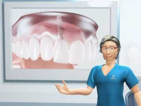 Gonartrosi della giunzione del ginocchio 1 farmaci grado Iniezioni nel prezzo ginocchio SPb