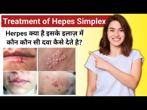 Herpifine cream, 5 grm