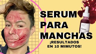 ESTE PRODUCTO DE $7 SÍ CAMBIA LA PIEL EN 10 MINUTOS! The Ordinary