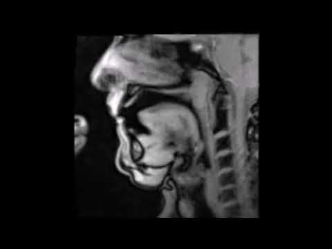 Horn playing in the MRI scanner