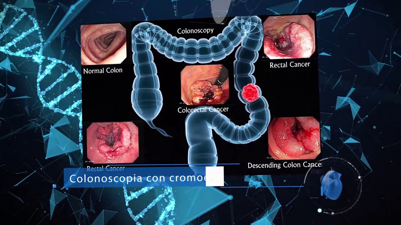 Sergio Torres Bailón-0