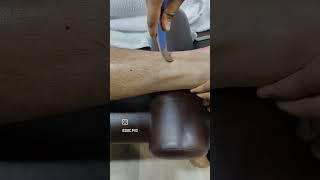 Sports massage and trigger point therapy for heel and ankle pain. #heelpainrelief #ankleinjury