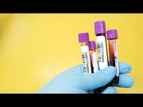 How to Measure Inflammation